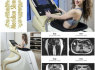 Parduodami Roll masažo aparatai, limfodrenazinis aparatas Vacu Evolution, Vibra platforma (18)