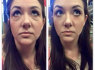 Instantly ageless - Momentinis atjauninimas (4)