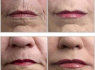Instantly ageless - Momentinis atjauninimas (5)