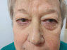 Instantly ageless - Momentinis atjauninimas (6)